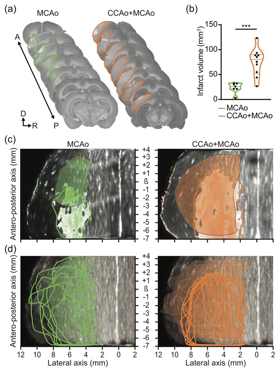 OpenfUS's tweet image. Our recent study demonstrates the capability of functional ultrasound imaging (fUS) to elucidate the relationship between the extent of brain infarcts and the occurrence of spreading depolarizations in ischemic stroke. Congratulations to @Clembrunner and the entire team !