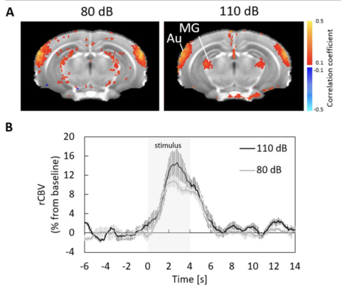 OpenfUS's tweet image. fMRI and fUS are two neuroimaging modalities that offer distinct advantages and limitations. The latest publication from Dr. Hikishima, and his team, sheds light on the disruption of resting-state functional connectivity caused by the high decibel levels in fMRI scanner @AIST_EN