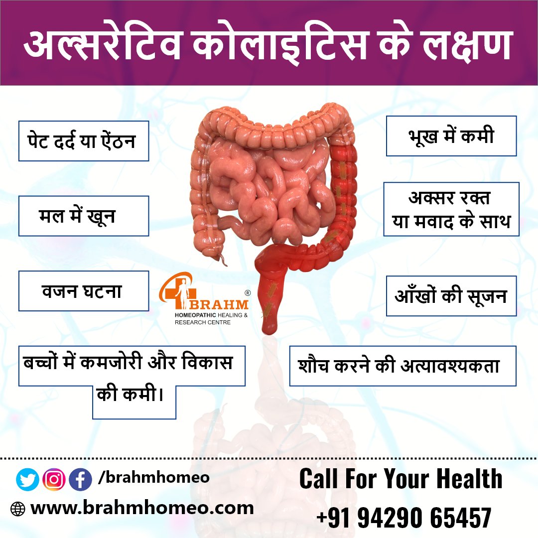BrahmHomeopathy's tweet photo. Symptoms of Ulcerative colitis
#drpradeepkushwaha #brahmhomeo #homeopathy #ulcerativecolitis #cuses #symptoms #treatment #health #healthcare #healthytip #homeopathyhealth #homeopathylifestyle #bestmedicine #viralpost #viralvideo #trending #ahmedabad https://t.co/HBVx5gqsF8