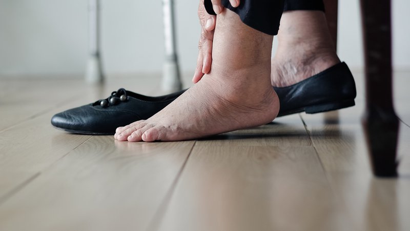 WebMD's tweet photo. Swollen feet can be concerning and even painful. What to know about possible causes and how to find relief: https://t.co/iTJ2oZy3Ub https://t.co/WhBx3GysHC