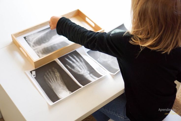OTEZ_EIE's tweet photo. Ayer celebramos en la guarde el día mundial de la radiografía. Realizamos juegos con la mesa de luz y aprendimos sobre el cuerpo humano 🧬🧪

#MiproyectodeEIE #Educacióninfantil #IESAlyanub #Vera @albertogsfol https://t.co/IdcP0cxCaD