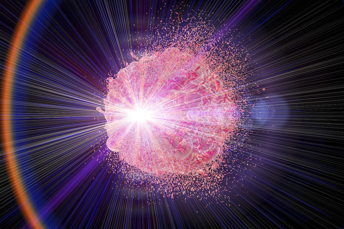 CancerWorld (@cancerworldmag) on Twitter photo Lethal to cancer cells but leaves healthy tissue largely untouched? It's almost the definition of a 'magic bullet'. <a href="/Simoncrompton2/">Simon Crompton</a> looks at the remarkable evidence on #FLASH ultra-high dose rate #radiationtherapy and asks: is it too good to be true? cancerworld.net/ultra-high-dos… Lethal to cancer cells but leaves healthy tissue largely untouched? It's almost the definition of a 'magic bullet'. <a href="/Simoncrompton2/">Simon Crompton</a> looks at the remarkable evidence on #FLASH ultra-high dose rate #radiationtherapy and asks: is it too good to be true? cancerworld.net/ultra-high-dos…