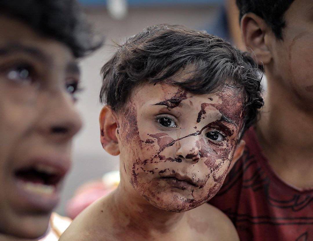 As a journalist, I would like to ask US Secretary of State <a href="/SecBlinken/">Secretary Antony Blinken</a> :

I won't ask if you're conscientiously at ease with your support to Israel’s killing of 4,300 children where you visited and expressed your solidarity as a Jew, because it seems you are.
My question is: