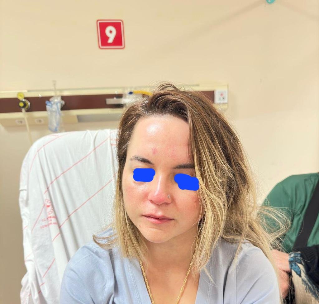 beta0607's tweet photo. Antalya Eğitim Araştırma Hastanesinde Çocuk Acil Polikliniğinde görevli arkadaşımız dün bir hasta yakından darp edilmiş olup 10 gün iş görmezlik raporu almıştır https://t.co/rPBOIJcSDM