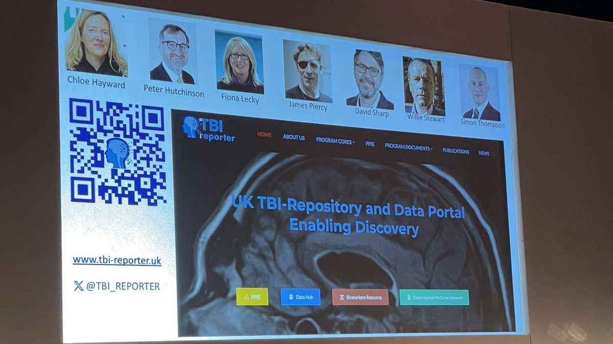 PINK Concussions 🧠 (@pinkconcussions) on Twitter photo Please spend a few minutes to check out the <a href="/TBI_REPORTER/">TBI-REPORTER</a> website - Prof. David Menon at #ukabifsummit23 conference speaking on the new TBI Reporter - UK TBI Platform <a href="/UKABIF/">United Kingdom Acquired Brain Injury Forum</a> <a href="/WillStewNeuro/">Dr Willie Stewart</a> Please spend a few minutes to check out the <a href="/TBI_REPORTER/">TBI-REPORTER</a> website - Prof. David Menon at #ukabifsummit23 conference speaking on the new TBI Reporter - UK TBI Platform <a href="/UKABIF/">United Kingdom Acquired Brain Injury Forum</a> <a href="/WillStewNeuro/">Dr Willie Stewart</a>