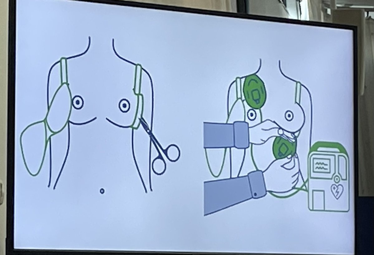 Caroline Leech (@leechcaroline) on Twitter photo Do you train bystanders to remove the bra and place AED pads correctly including under (not over) the left breast? #FPHC2023 <a href="/drrichardlyon/">Richard Lyon</a> Do you train bystanders to remove the bra and place AED pads correctly including under (not over) the left breast? #FPHC2023 <a href="/drrichardlyon/">Richard Lyon</a>