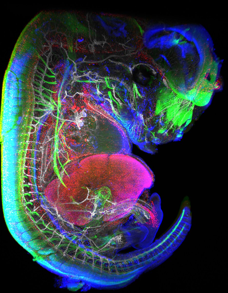 Learn more about our 2022 France-BioImaging #ImageContest winners! 🏆🔬 🥇Carole Siret, @CIML_Immunology Thanks to lightsheet microscopy, her image shows the dynamics at work in this 13.5-day-old mouse embryo! 👉Full article on france-bioimaging.org/announcement/f…