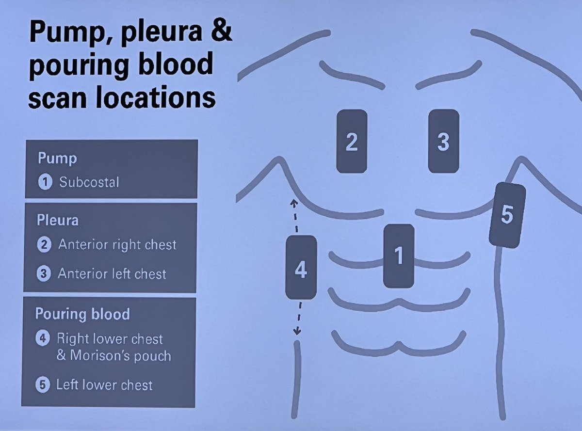 fredcj's tweet photo. Pump, Pleura &amp; Pouring Blood. Great talk by Dr Dan Nevin &amp; Mike Palmer on point of care ultrasound. #FPHC2023 #PHEM #IBTPHEM https://t.co/zuQ3eJXabL