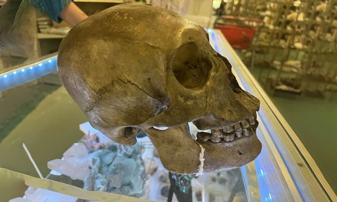 দাতব্য দোকানে মানুষের খুলি