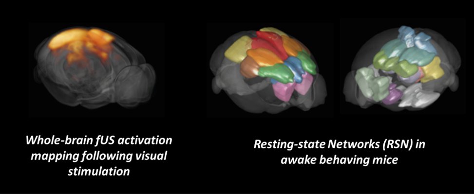 Iconeus (@iconeus) on Twitter photo ๐จNEW ARTICLE ALERT ๐จ
โHigh sensitivity mapping of brain-wide functional networks in awake mice using simultaneous multi-slice fUS imagingโ out in <a href="/ImagingNeurosci/">Imaging Neuroscience</a> ๐จNEW ARTICLE ALERT ๐จ
โHigh sensitivity mapping of brain-wide functional networks in awake mice using simultaneous multi-slice fUS imagingโ out in <a href="/ImagingNeurosci/">Imaging Neuroscience</a>