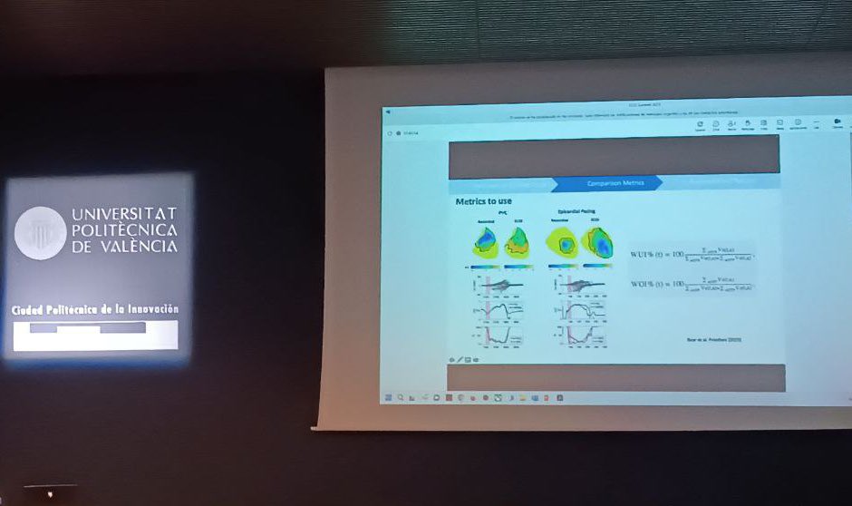 ecgisummit's tweet image. At #ECGISummit2023, Laura Bear @bearinfrance  presents &quot;Validation of ECGI using Large Experimental Models.&quot;