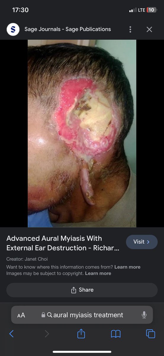 DivinePrinceSA's tweet photo. @GYerathel Advanced Aural Myiasis https://t.co/g5du79g2xS