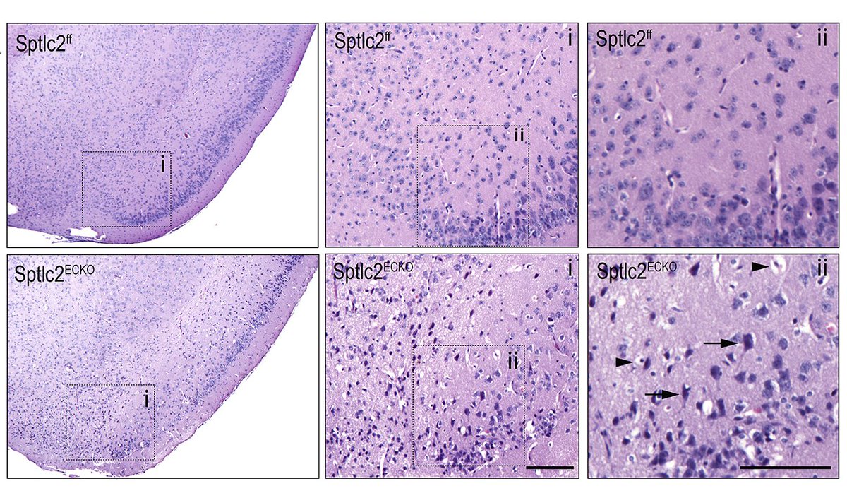 Rubinelli &amp; colleagues found that #endothelial #sphingolipid de novo biosynthesis is necessary to preserve #cerebrovascular homeostasis. Learn more at ahajrnls.org/3QLxS4a 

<a href="/ar_dilorenzo/">Annarita Di Lorenzo</a> <a href="/Anna79037733/">Anna</a> <a href="/LindaSasset/">Linda Sasset</a>