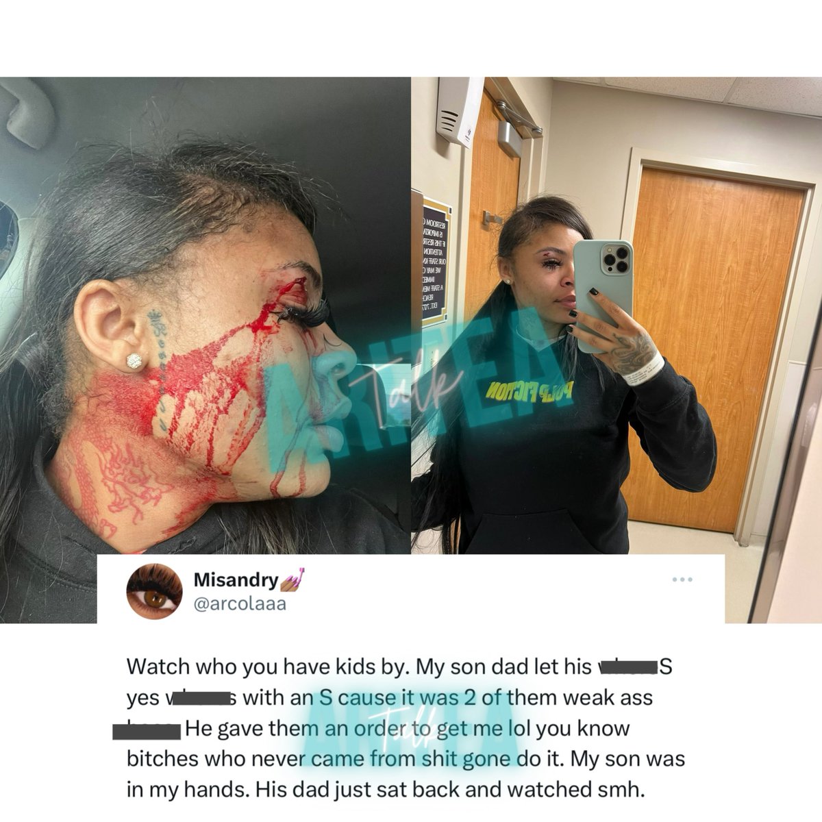 NO IG ARI ❥ tweet media