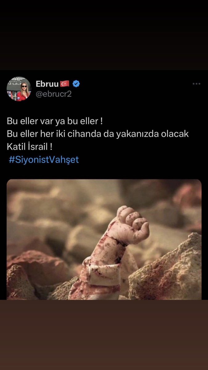 #Bebekkatiliİsrail # kahrolisrail #kafirisrail #FreePalestineNow #Gaza