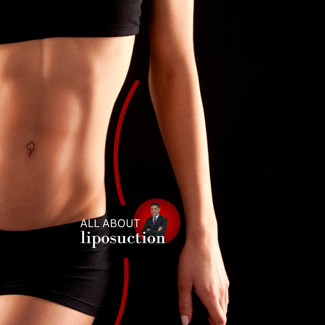 asasurgery's tweet photo. Considering liposuction? 🔍

Dr. Jikaria’s guide makes it easy for you to understand what liposuction is, how it’s done and what to expect in just a few minutes! 

Watch now ⬇️

https://t.co/BQIfHgrEmw https://t.co/omW0QOShF7