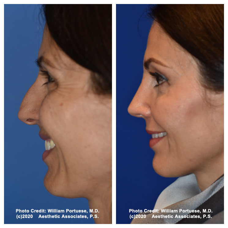 The Portland Center for Facial Plastic Surgery tweet media