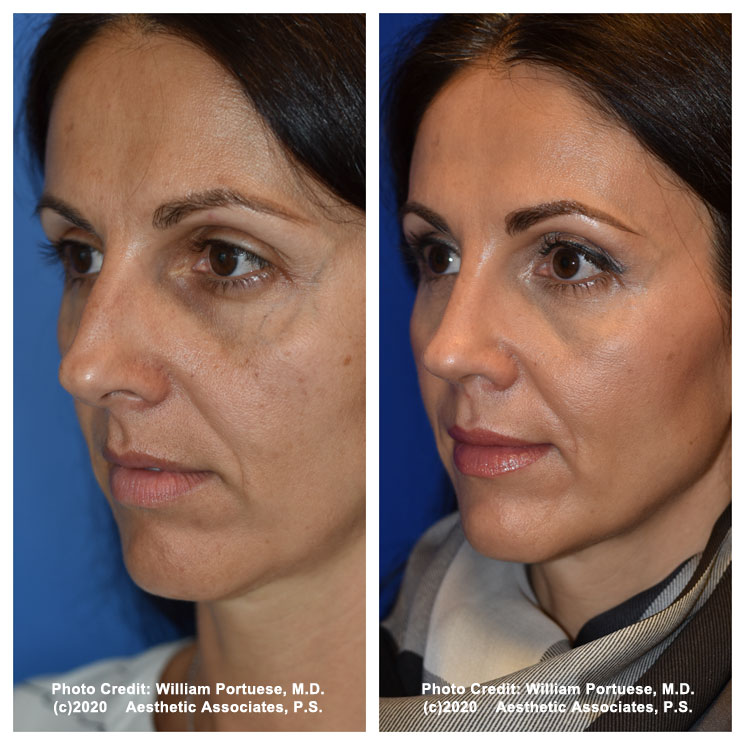 The Portland Center for Facial Plastic Surgery tweet media