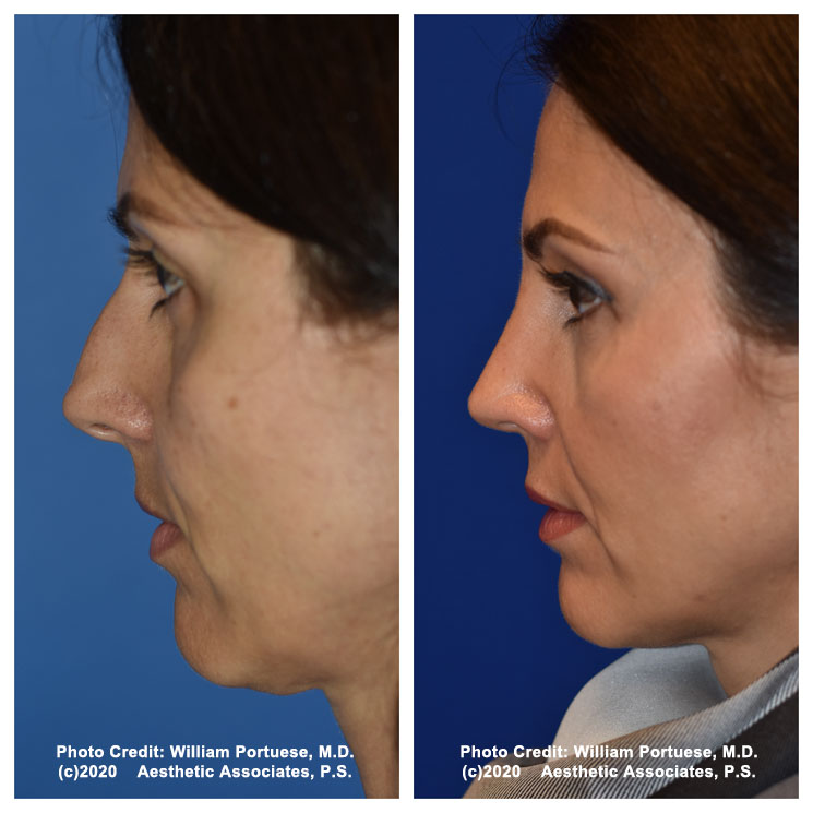 The Portland Center for Facial Plastic Surgery tweet media