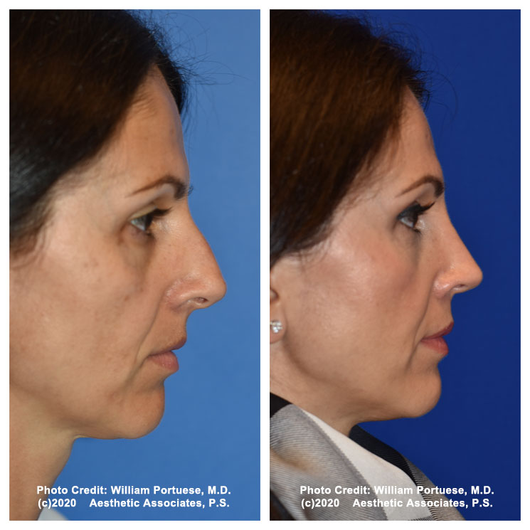 The Portland Center for Facial Plastic Surgery tweet media