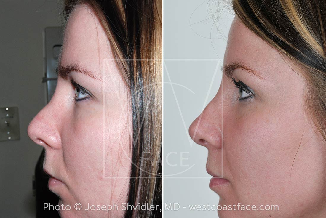 The Portland Center for Facial Plastic Surgery tweet media