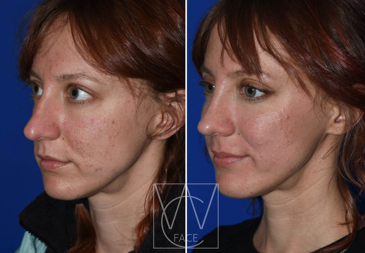 The Portland Center for Facial Plastic Surgery tweet media