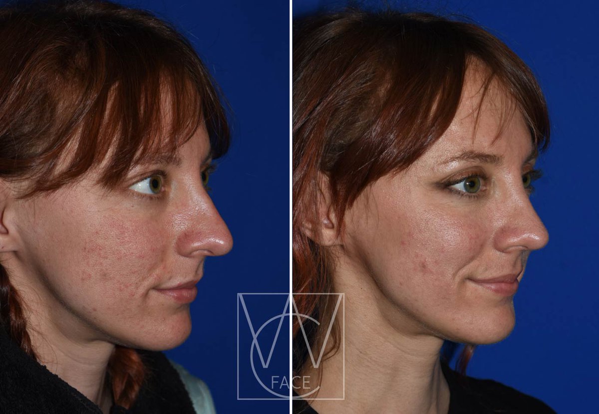 The Portland Center for Facial Plastic Surgery tweet media