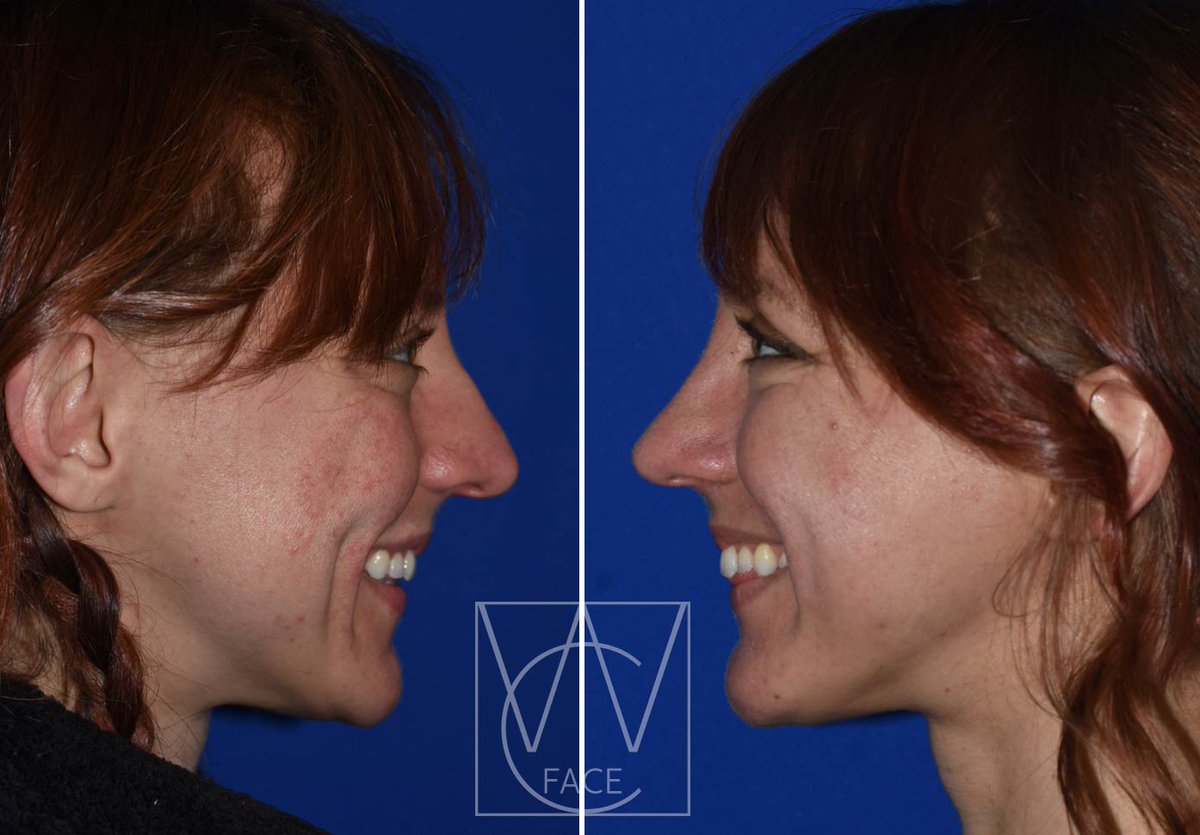 The Portland Center for Facial Plastic Surgery tweet media