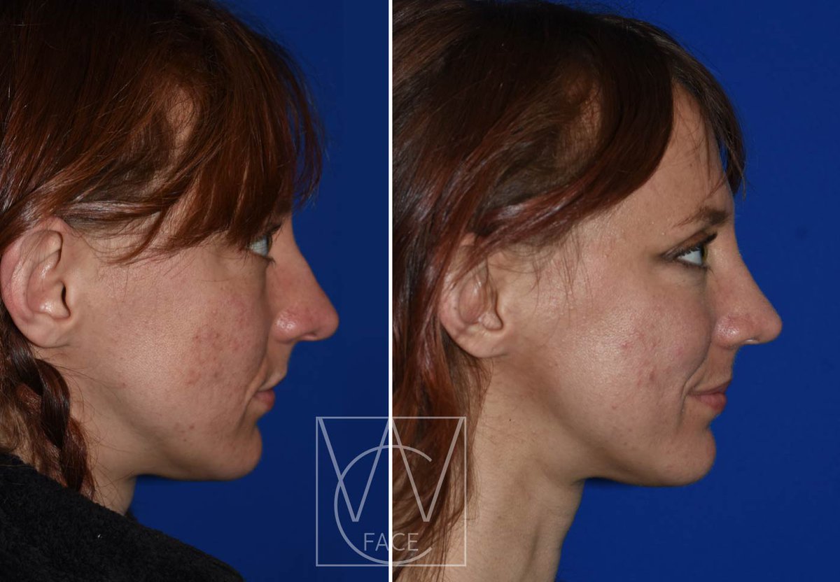 The Portland Center for Facial Plastic Surgery tweet media