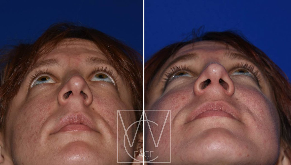 The Portland Center for Facial Plastic Surgery tweet media