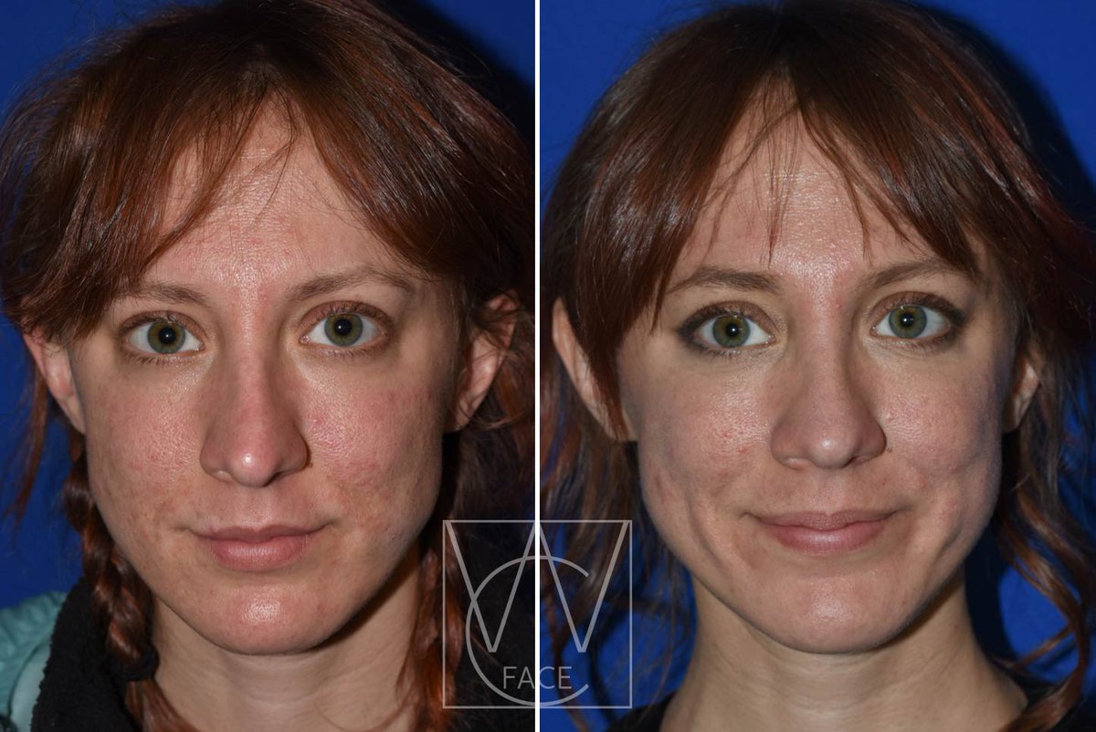 The Portland Center for Facial Plastic Surgery tweet media