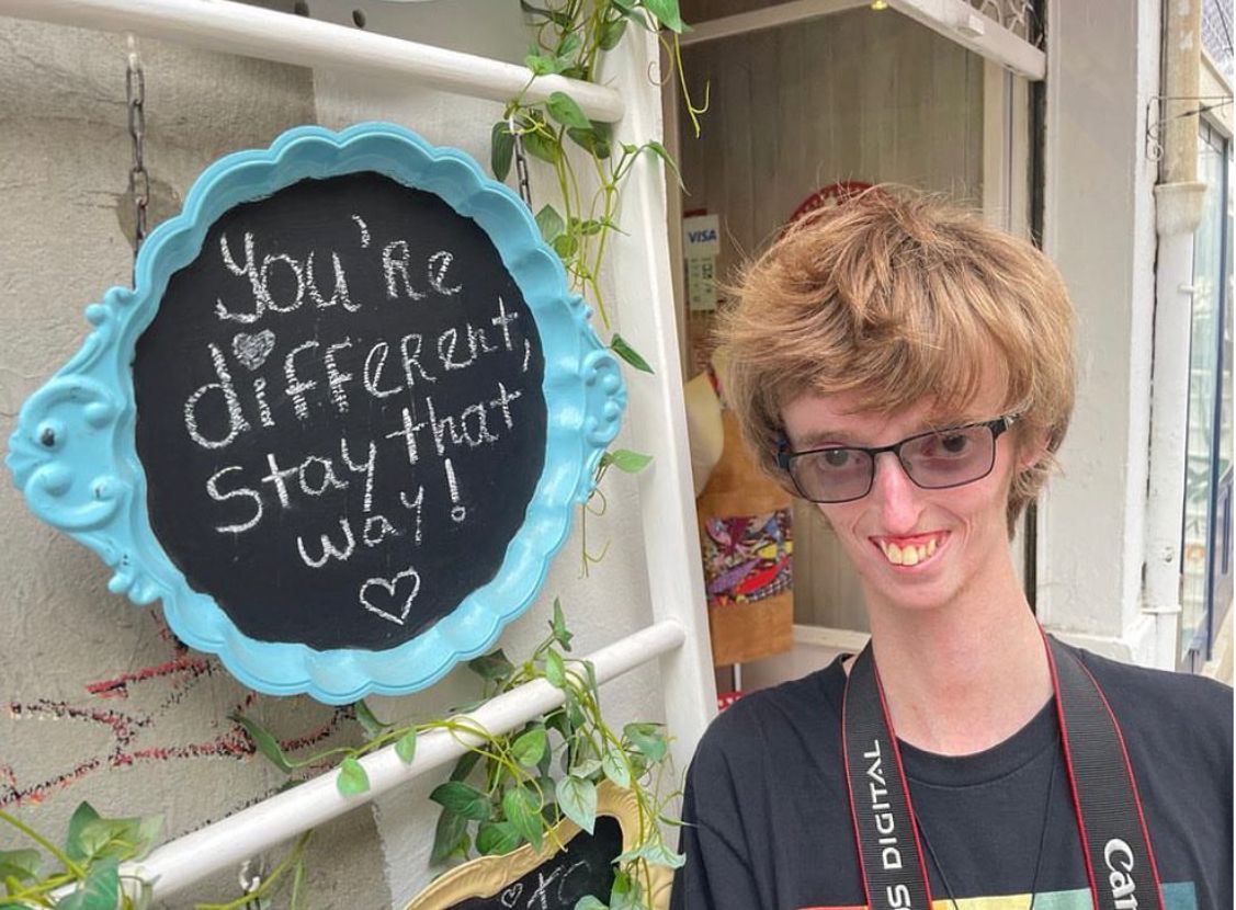 FaceEquality's tweet photo. “I love watching movies but I’m always seeing people with facial differences portrayed in a way that’s not positive."

A big thank you to Dylan, who is supporting our #IAmNotYourVillain campaign.

Dylan spoke to Glasgow Times: https://t.co/HCpD3J5zXG https://t.co/gEz4gT1L0M