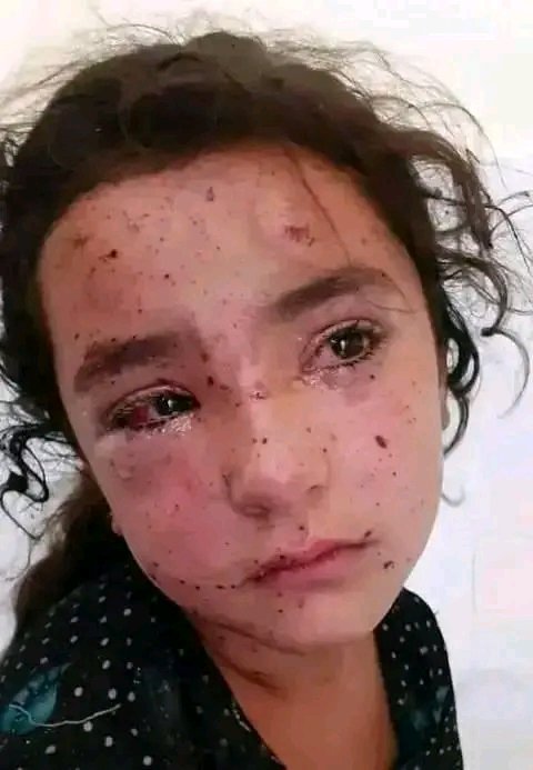 mhy77235's tweet photo. لا أحد يهتم لانها طفلة فليسطينية 
أريد لهذه الصورة أن تسافر حول العالم .. لو حدث شيء هكذا في دول غريبة فالعالم كله سيهتز لكن لأنها طفلة فلسطينية لا أحد يهتم 
#غزه_تقاوم_وستنتصر 
#امريكا_واسرائيل_ام_الارهاب https://t.co/NZhMR0I4Go
