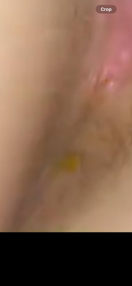 dontplayts's tweet photo. @freakkayy20 Boy you almost ate some dookie 💩 https://t.co/SU0JmDGU5M