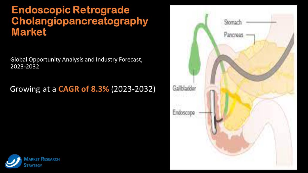 Endoscopic Retrograde Cholangiopancreatography (ERCP) Market 𝐆𝐫𝐚𝐛 𝐅𝐫𝐞𝐞 𝐒𝐚𝐦𝐩𝐥𝐞 𝐏𝐃𝐅 𝐑𝐞𝐩𝐨𝐫𝐭 @ lnkd.in/d5bdcTW7 #EndoscopicRetrogradeCholangiopancreatography