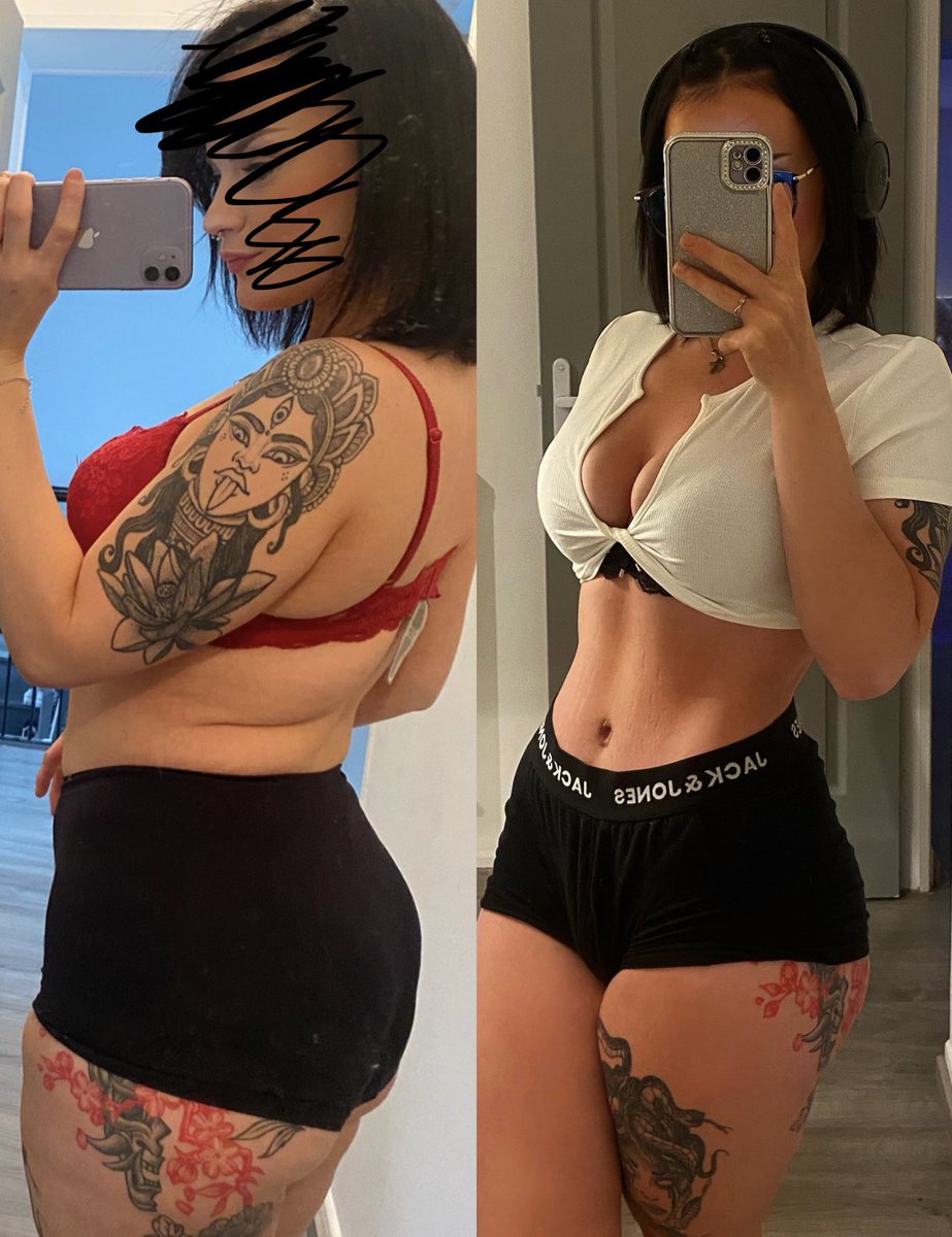 La meilleure décision de toute ma vie. 
Bodylift + perte de 6kg 🥰

Je ne baisserai plus jamais les bras