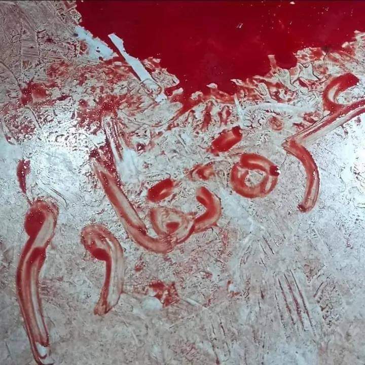 #غزه_تقاوم_وستنتصر
أنا لم أعتد المشهد وفي كل مرة ينفطر قلبي وكأنها المرة الأولىٰ)"