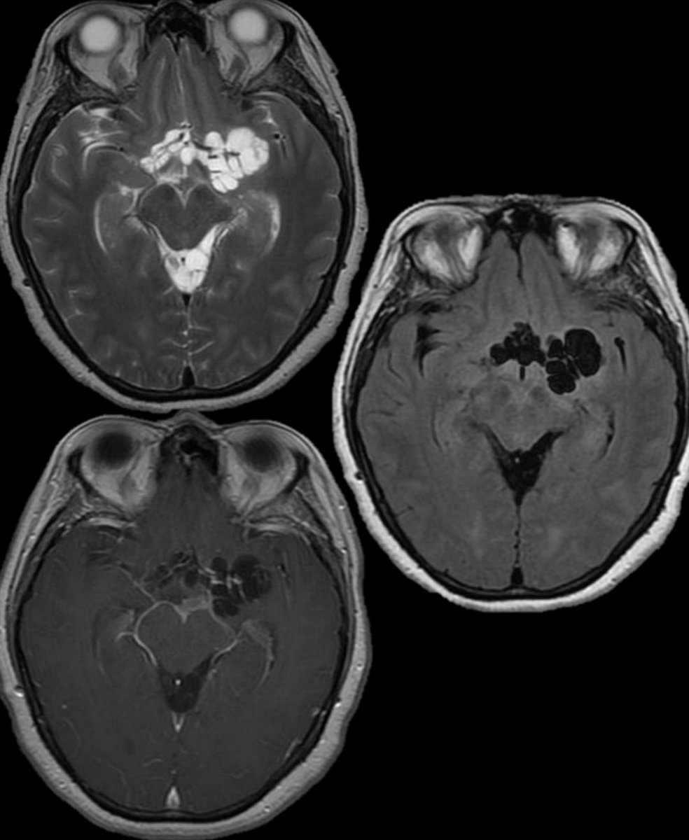 Evan Calabrese, MD PhD tweet media