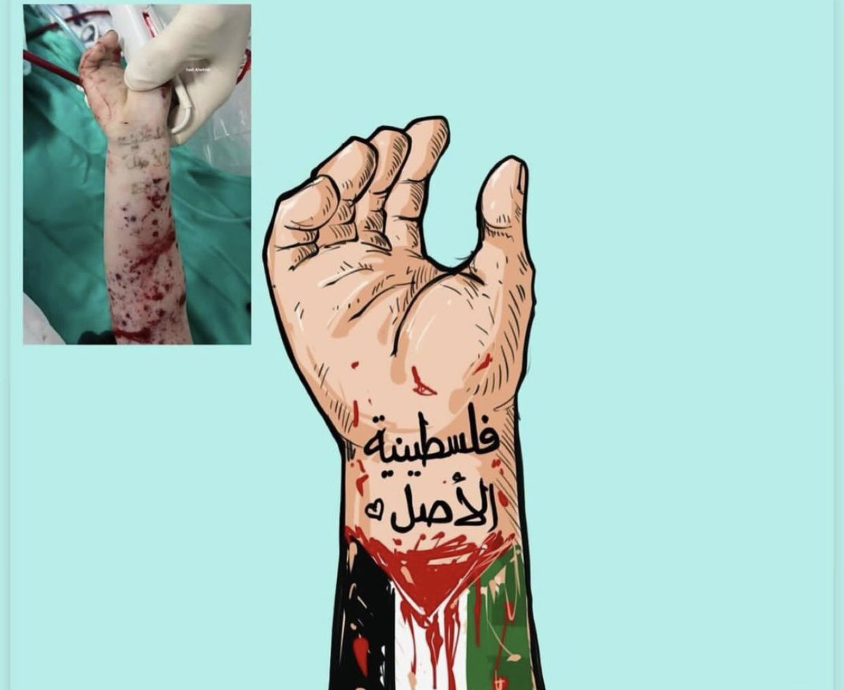 Hayffoufafette's tweet photo. #فلسطنية الاصل…
#غزة_الآن 
#غزه_تنتصر 
#Gaza_Geniocide 
#Gaza 
##حماس https://t.co/vLK2vgewCq