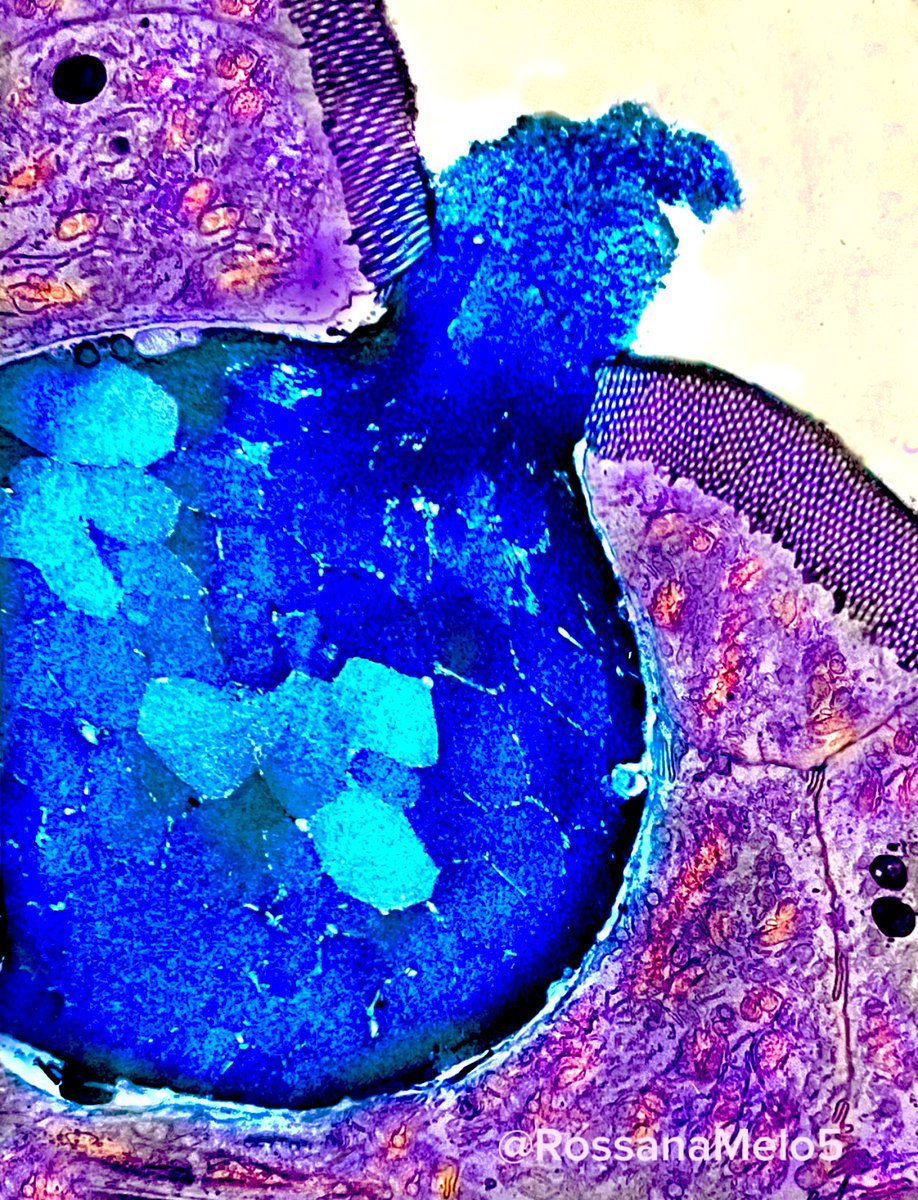 When you capture the exact moment a gorgeous #gobletcell is erupting mucus in the human intestine! 💙
#MicroscopyMonday #sciart