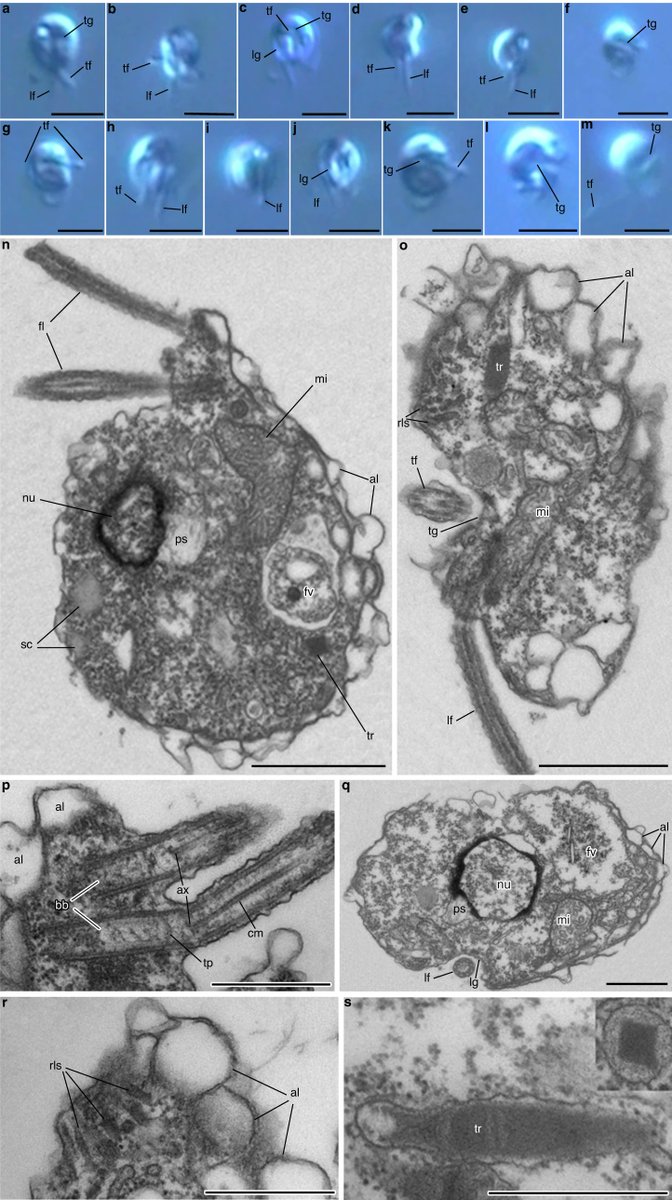 protistologists's tweet image. Multiple parallel origins of parasitic Marine Alveolates | Corey C Holt, Elisabeth Hehenberger, Denis V Tikhonenkov, Victoria K L Jacko-Reynolds, Noriko Okamoto, Elizabeth C Cooney, Nicholas A T Irwin, Patrick J Keeling 
nature.com/articles/s4146…