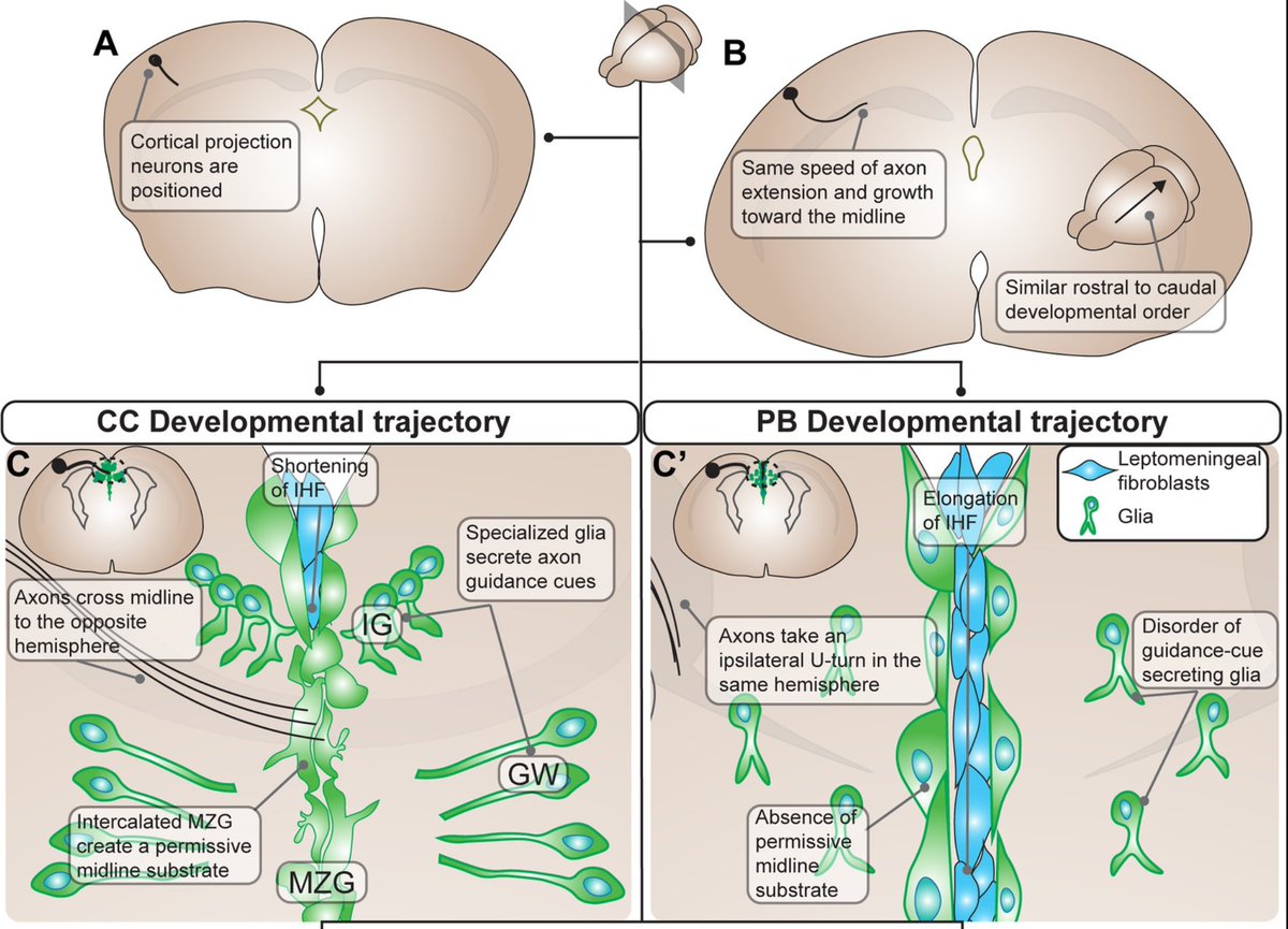 Laura Fenlon PhD (@laurarosefenlon) on Twitter photo New review out from the lab about perhaps the largest stereotypical aberrant tract in the brain: Probst bundles. Led by the wonderful <a href="/ZoranaLynton/">Zorana Lynton</a>, what can their natural formation teach us about brain plasticity and compensation? frontiersin.org/articles/10.33… New review out from the lab about perhaps the largest stereotypical aberrant tract in the brain: Probst bundles. Led by the wonderful <a href="/ZoranaLynton/">Zorana Lynton</a>, what can their natural formation teach us about brain plasticity and compensation? frontiersin.org/articles/10.33…