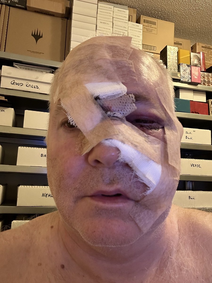 HAPPY HALLOWEEN! Too late? Oh well, I tried🫤 I got out of hospital today.  Happy the big surgery is done, happy to be home. I’m determined to make Eternal Weekend Prague in 11 days. I’ve promised 3 Legacy decks and my 4 sets of Power so people can play. Tons of sleep now.