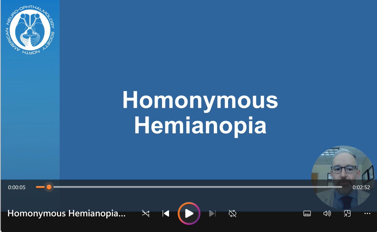 NANOSTweets's tweet image. 🧠 Homonymous Hemianopia: A unique visual condition caused by brain damage.  Learn more: bit.ly/HomonymousHemi…🔔

Support #NANOS, a non-profit advancing neuro-ophthalmology and helping patients. Donate now: nanosweb.org/donations 📢