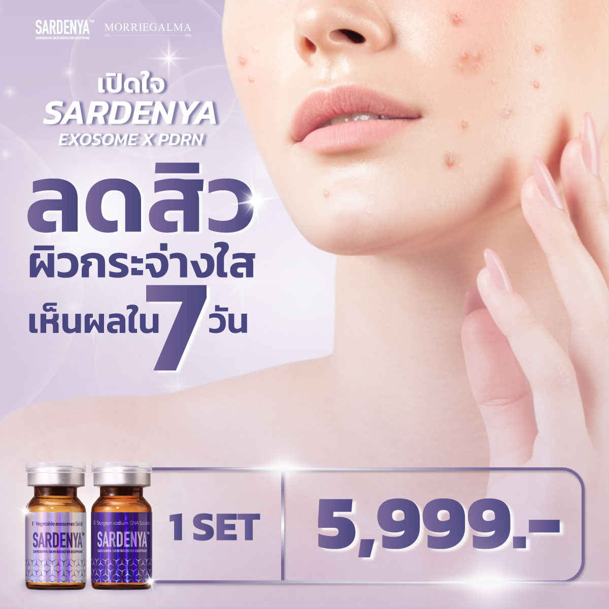 bf_clinic_'s tweet photo. ต้องลอง!! Exosome x PDRN รักษาสิวตัวแรกของโลก 💜✨" Sardenya " เหมาะสำหรับคนมีปัญหาสิวกวนใจ มีเฉพาะที่ Best Friend Clinic เท่านั้น

‼️5,999.- เท่านั้น‼️

✅ แก้ปัญหาสิว หลุมสิวและรอยสิว
✅ ลดริ้วรอย บูสเตอร์หน้าเด็ก
✅ ลดฝ้า กระ จุดด่างดำ
✅ ช่วยปรับผิวสว่างกระจ่างใส https://t.co/NXYRTGcszN