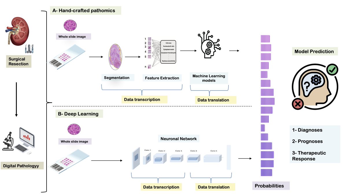 Thrilled to report our latest paper 'Clinical Application of Digital and Computational Pathology in Renal Cell Carcinoma: A Systematic Review' in the @EurUrolOncol @SoleneKammerer @VitalyMargulis @MRoupret @kbensalah35 @CHURennes @UTSWUrology euoncology.europeanurology.com/article/S2588-…