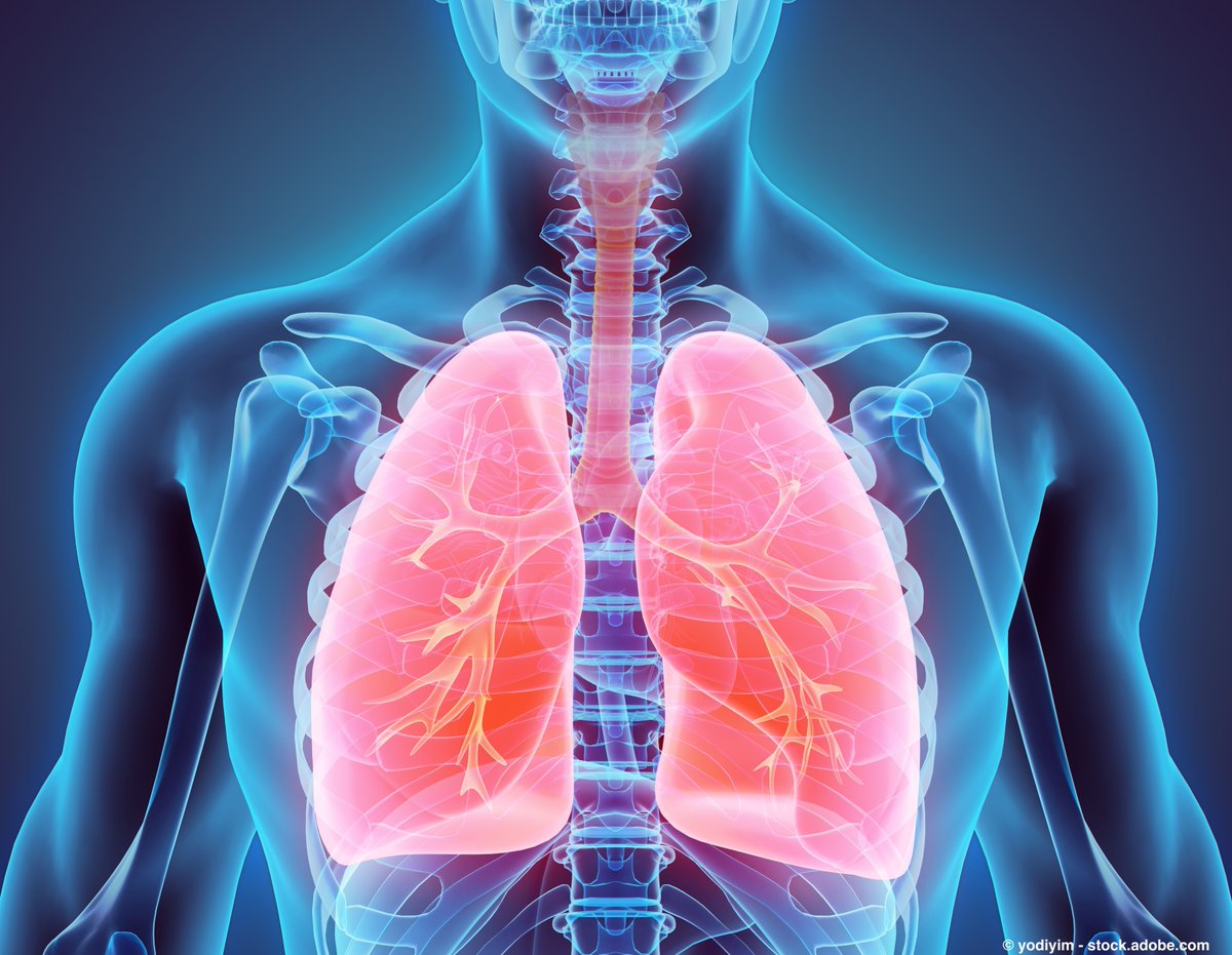 OncLive.com (@onclive) on Twitter photo SCLC has continued to evolve in recent years, in part from  IO/chemotherapy combinations in the frontline setting with atezolizumab and durvalumab, respectively. <a href="/teekayowo/">Taofeek K Owonikoko</a> <a href="/KLeventakos/">Kostas Leventakos</a> <a href="/sands_jacob/">Jacob sands</a> <a href="/Annechiangmd/">Anne Chiang</a> <a href="/MayoClinic/">Mayo Clinic</a> <a href="/DanaFarber/">Dana-Farber</a> @yalemed #lcsm onclive.com/view/novel-fro… SCLC has continued to evolve in recent years, in part from  IO/chemotherapy combinations in the frontline setting with atezolizumab and durvalumab, respectively. <a href="/teekayowo/">Taofeek K Owonikoko</a> <a href="/KLeventakos/">Kostas Leventakos</a> <a href="/sands_jacob/">Jacob sands</a> <a href="/Annechiangmd/">Anne Chiang</a> <a href="/MayoClinic/">Mayo Clinic</a> <a href="/DanaFarber/">Dana-Farber</a> @yalemed #lcsm onclive.com/view/novel-fro…