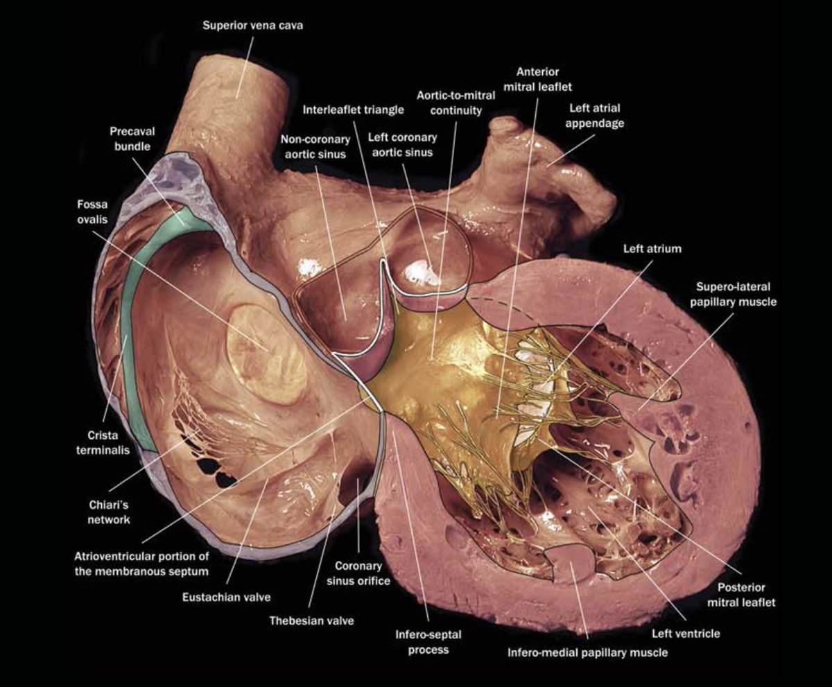 The membrane component underlying the non-coronary sinus where only atrial signals can be recorded when the electrode is positioned there.