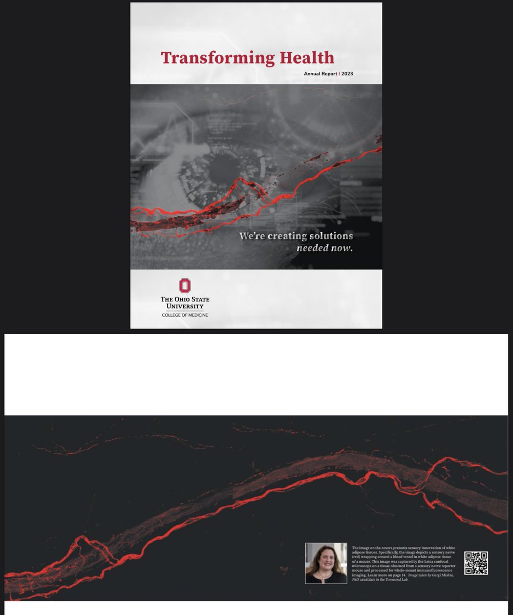 neuroadipo's tweet image. Nice nerve, @gargi_mishra2! Our lab’s image of an adipose sensory nerve is featured on the cover of this year’s @OhioStateMed college annual report.  Learn more about 2023 college research news medicine.osu.edu/-/media/files/…