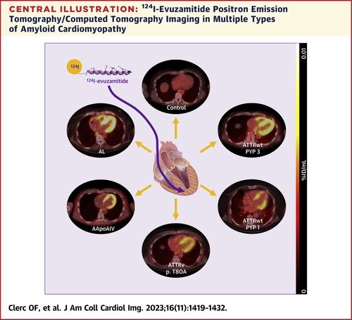 Have you heard of iodine (124I) evuzamitide (124I-P5+14)? Two papers show that this might be the next big thing for the imaging of cardiac amyloidosis.